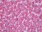 MNSOD / SOD2 Antibody